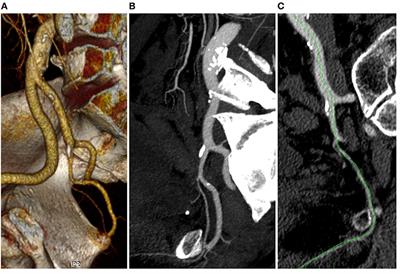 Frontiers Prevalence of Erectile Dysfunction in Patients With